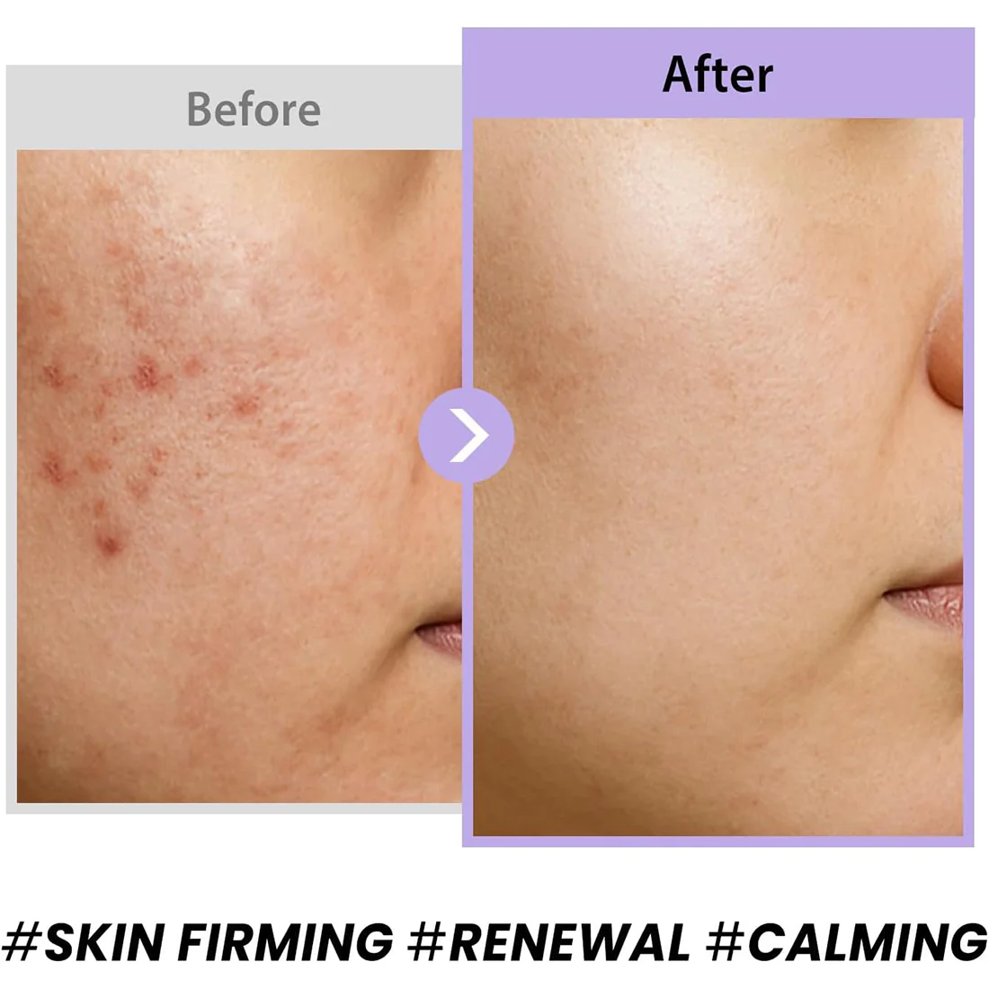 Black Snail Collagen Cream Crema Antirughe - Image 4