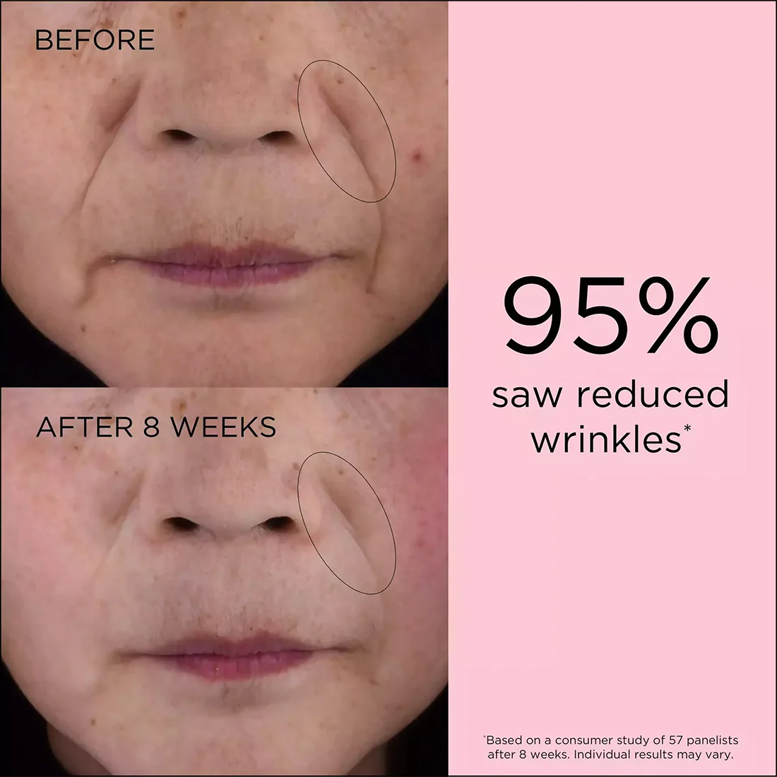 Retinol + HPR Ceramide Capsules Rapid Skin Renewing Serum Capsule Siero Rinnovatore - Image 4