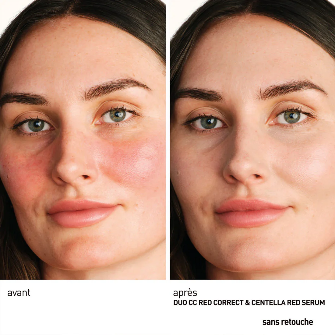 Centella Red Serum Siero viso lenitivo - Image 3
