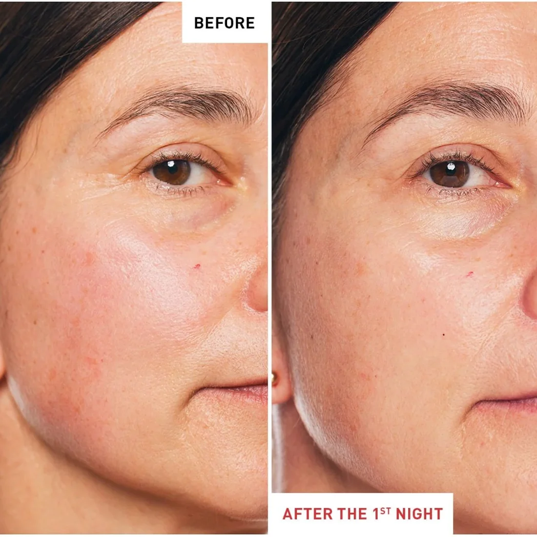 Skin Therapy Night Oil Olio viso effetto globale - Image 4