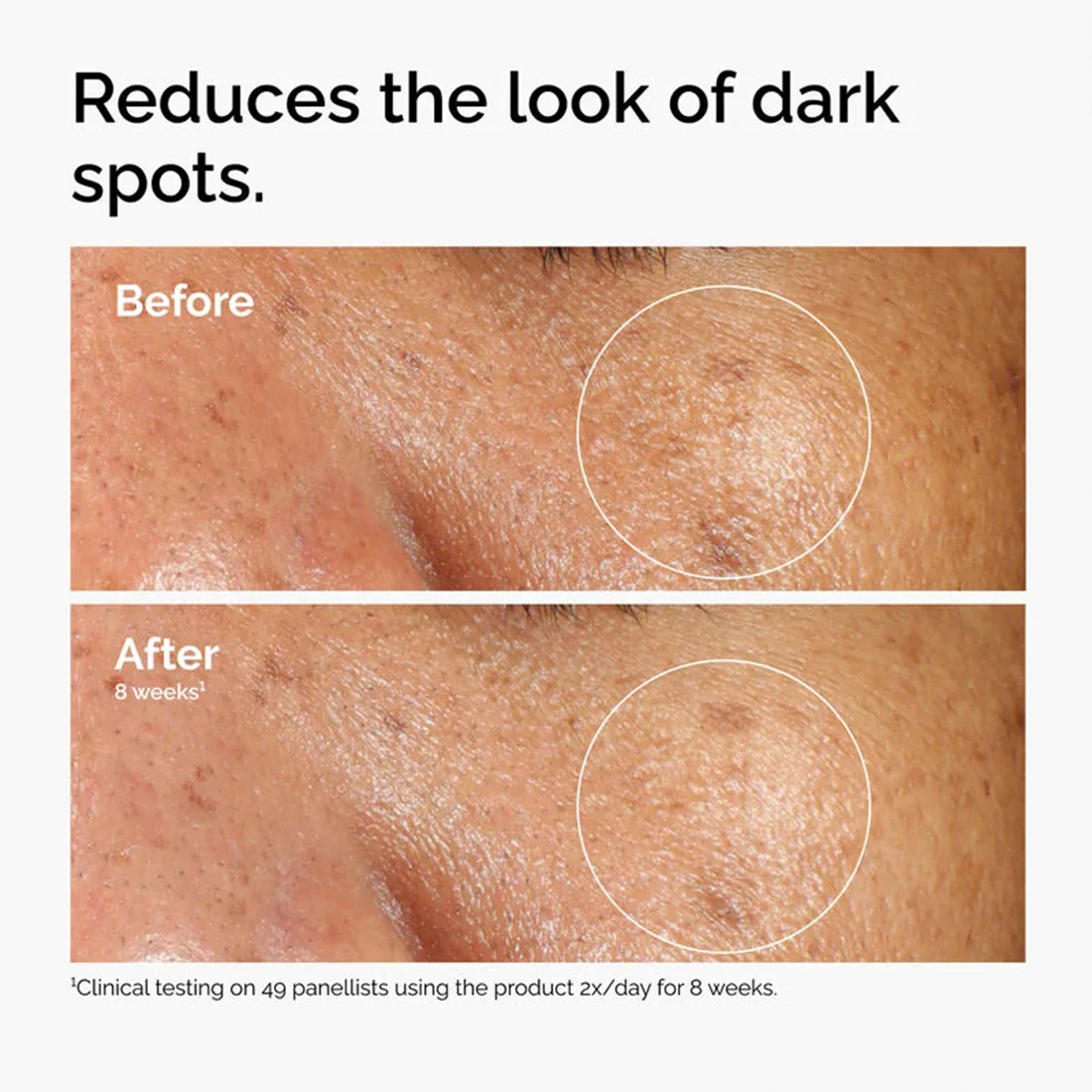 Alpha Arbutin 2% + Ha Siero Antimacchie - Image 4