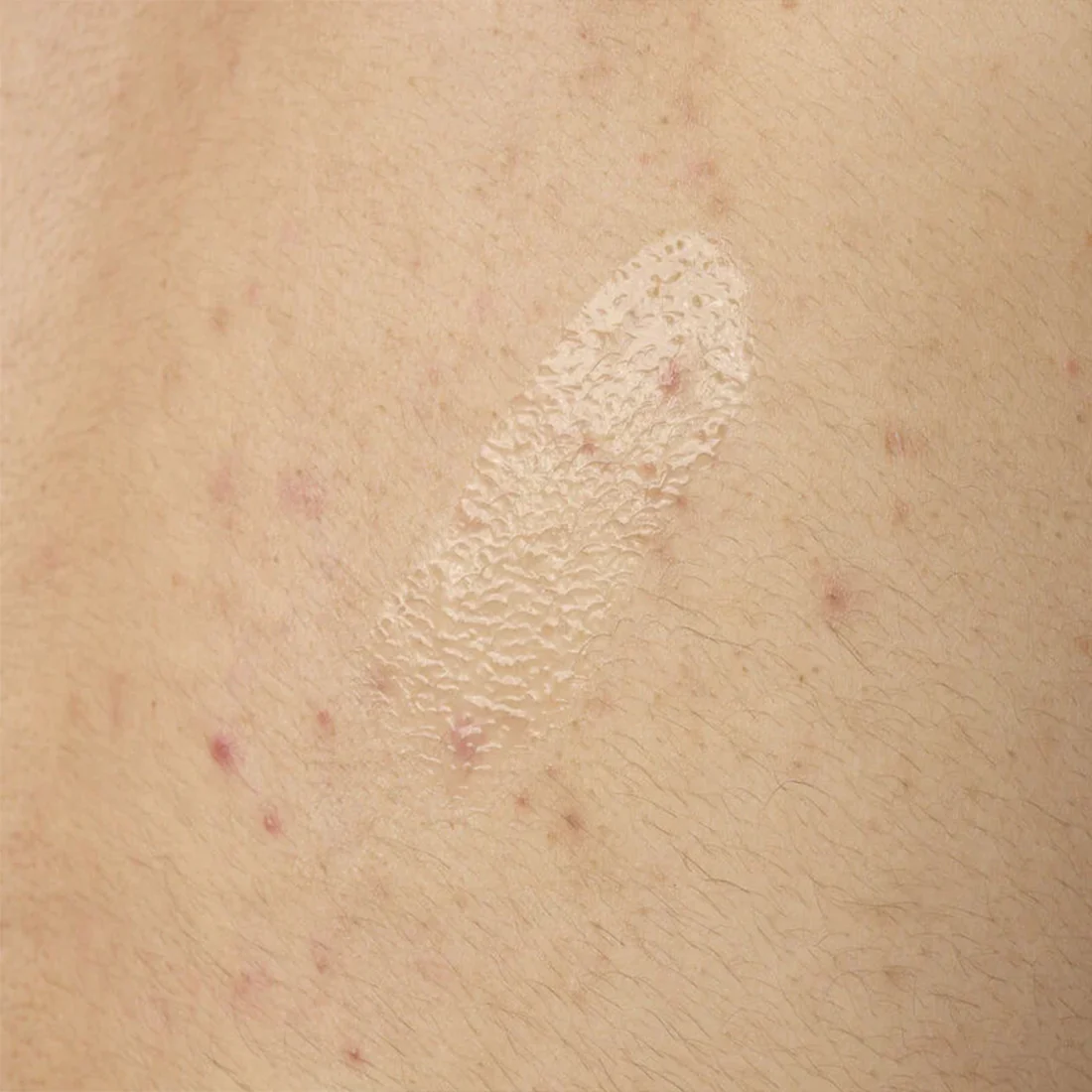Salicylic Acid 0,5% Body Serum Siero Esfoliante Corpo - Image 3